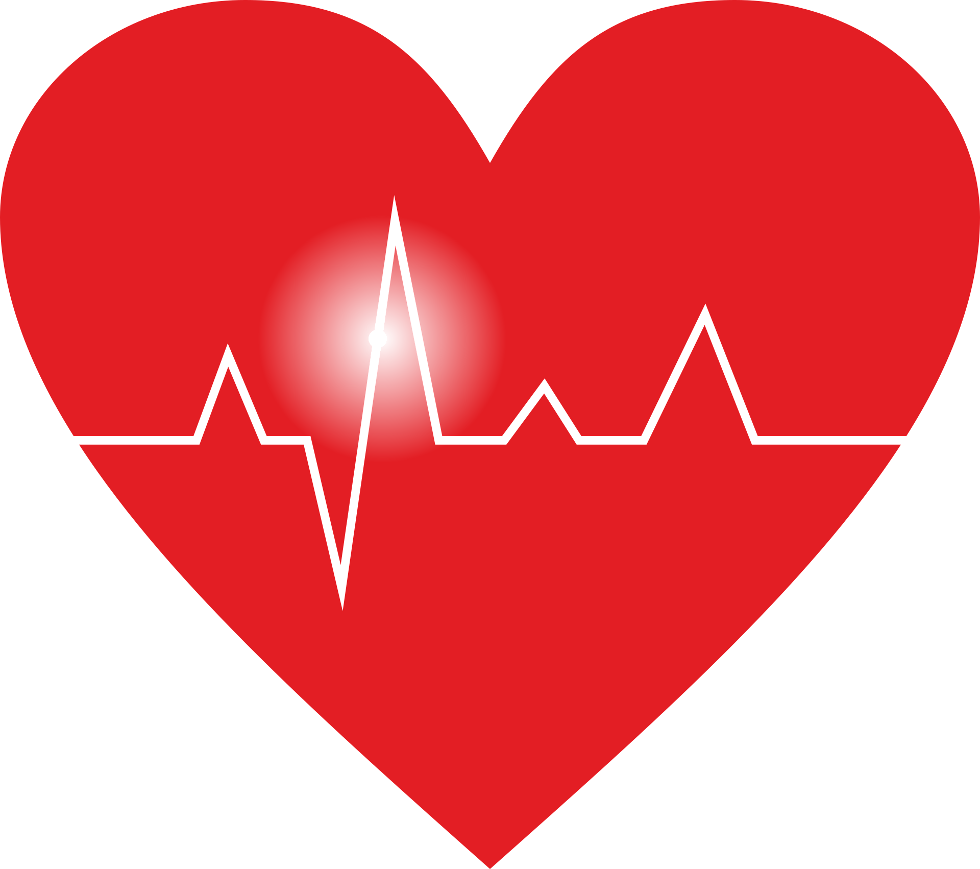 La cohérence cardiaque : Un outil puissant (même en entreprise !)